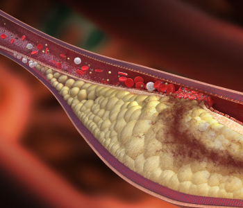 Walls of blood vessels.